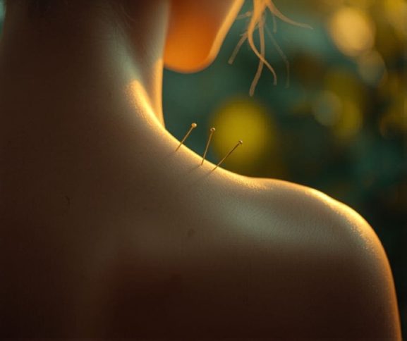 Séance d'acupuncture pour accompagner la perte de poids